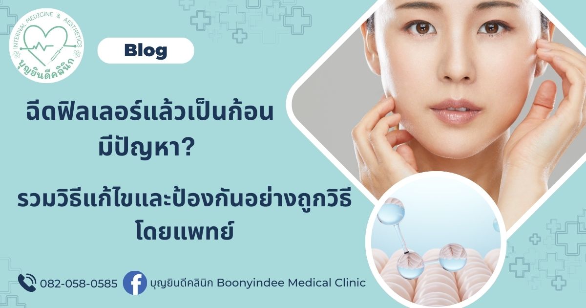 filler complication management